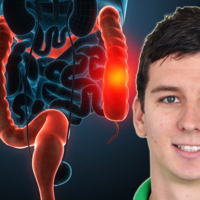 James Devin has studied the effects of exercise on colorectal cancer survivors.